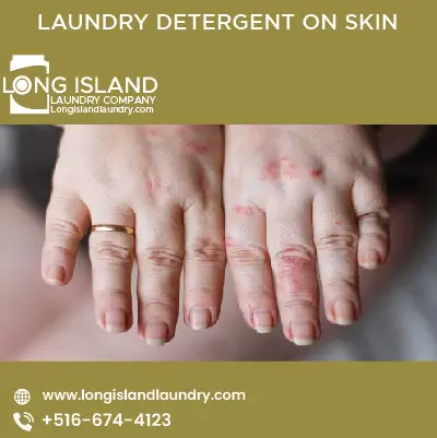 laundry detergent on skin